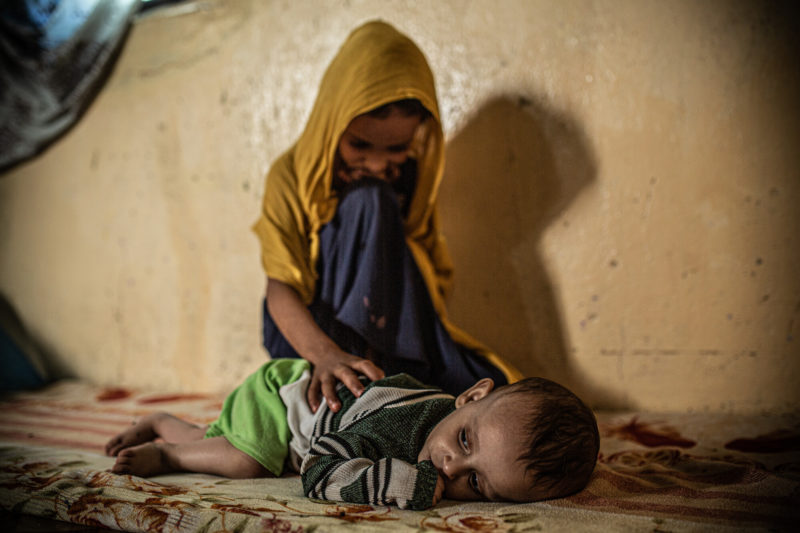 Yemen dopo anni l'incubo carestia, 2 milioni i bambini gravemente malnutriti