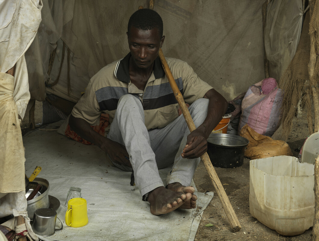 Khamis Adam Mohammed, 33 anni, nel suo rifugio di fortuna nel centro di transito di Renk. Khamis si è ferito a una gamba mentre scappava dai soldati in Sudan. Credit: Peter Caton/Oxfam 
